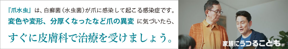 『爪水虫』は、白癬菌(水虫菌)が爪に感染して起こる感染症です。変色や変形、分厚くなったなど爪の異変に気づいたら、すぐに皮膚科で治療を受けましょう。